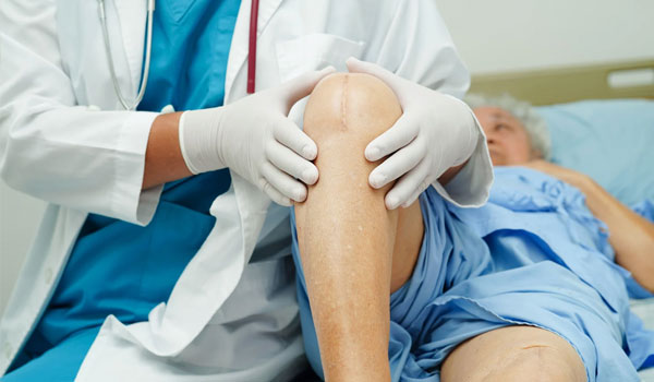 Knee Replacement Surgery